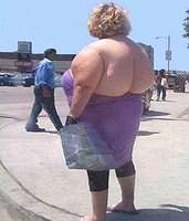 butt lift